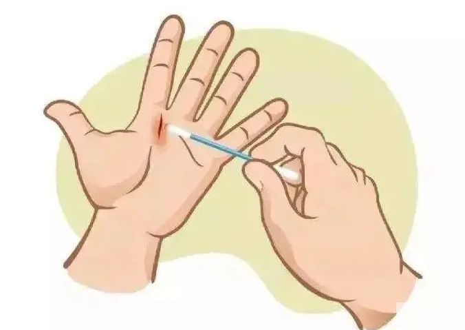 宝宝擦伤后，如何处理，避免疤痕发生? 图片-6