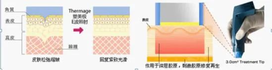 不同的年龄段适合什么医美项目? 图片-4
