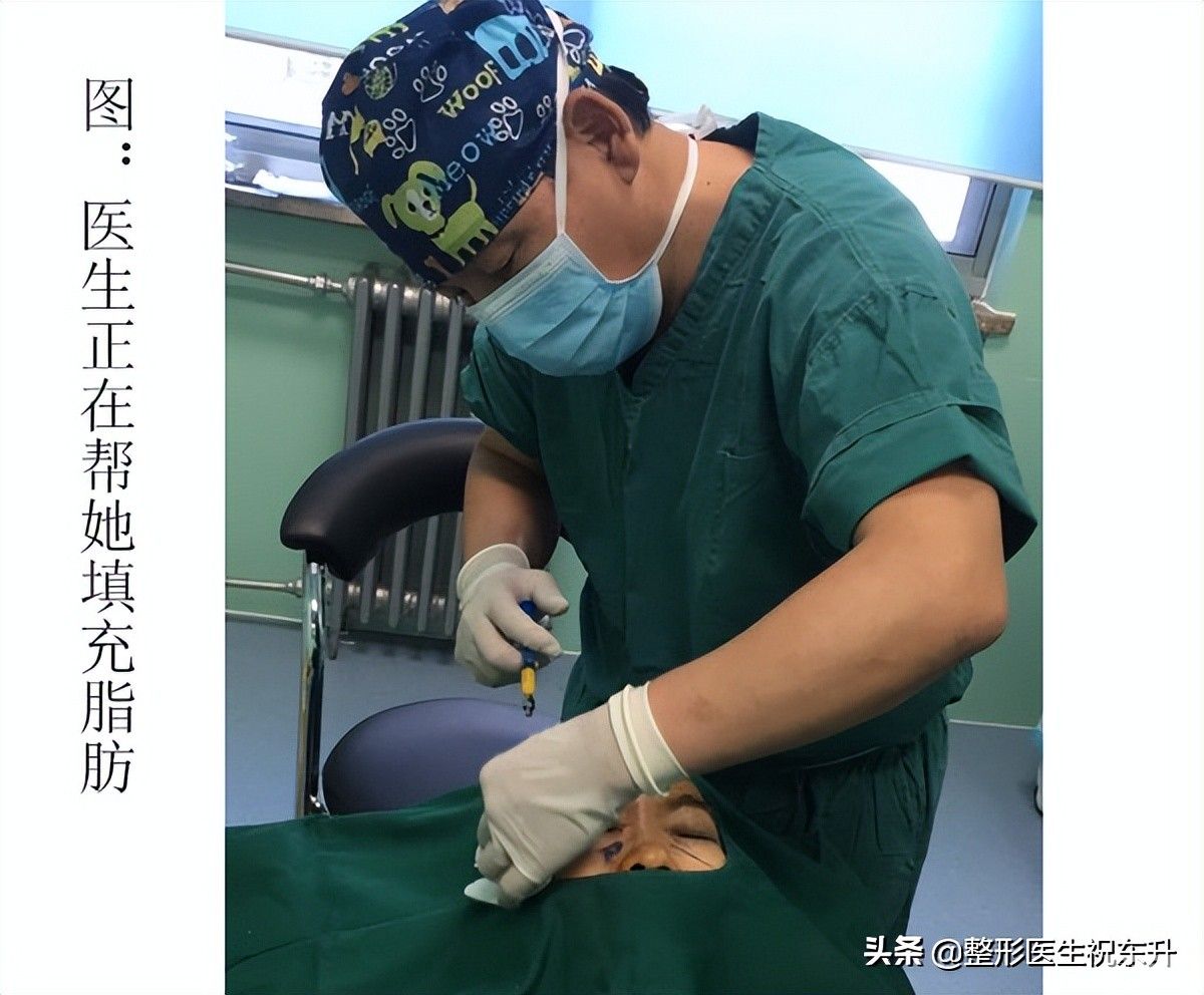 想变年轻又不想动刀的人，看过来!不妨试试这几个整容项目 图片-2