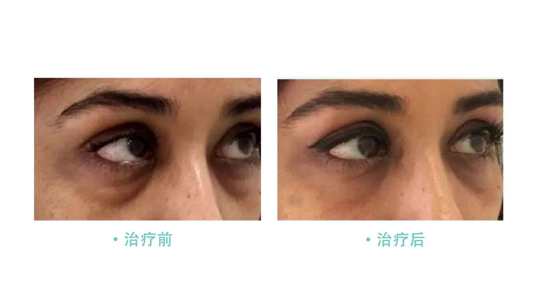 瑞蓝唯瑅 