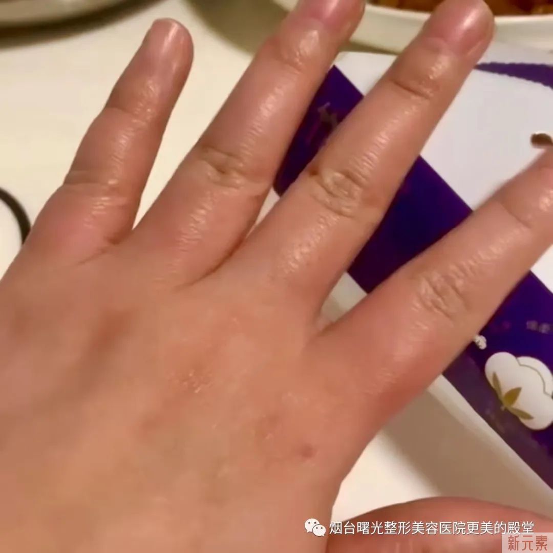 这双手的主人经历了什么?—烟台防疫故事(7) 图片-5