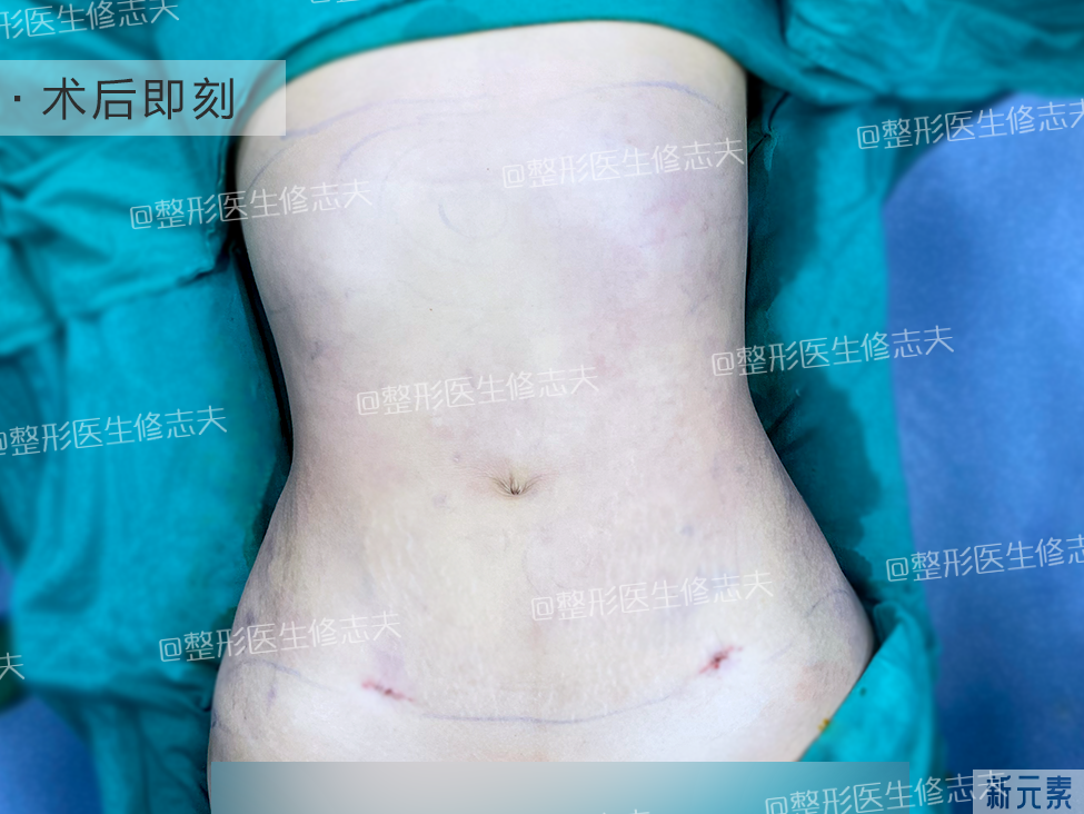 同样是腰，为何别人的腰线那么优秀? 图片-8
