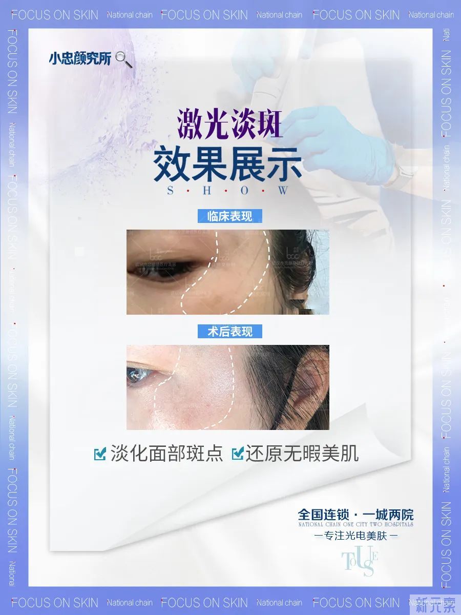能美白、淡斑、收缩毛孔一键三联的它，可不仅仅是祛斑神器! 图片-9