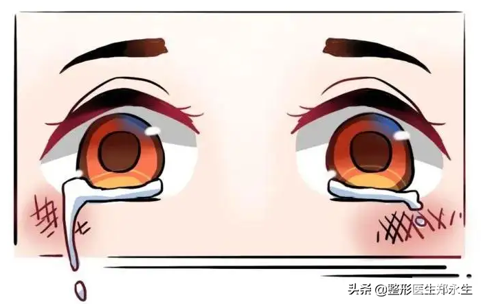 医生告诉你:眼袋手术也有禁忌，做眼袋前，你必须知道的10件事 图片-1