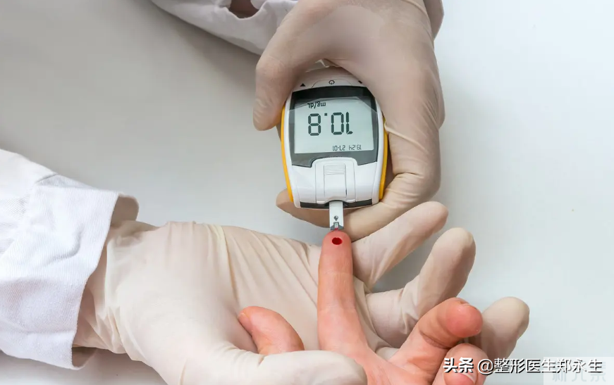 医生告诉你:眼袋手术也有禁忌，做眼袋前，你必须知道的10件事 图片-4