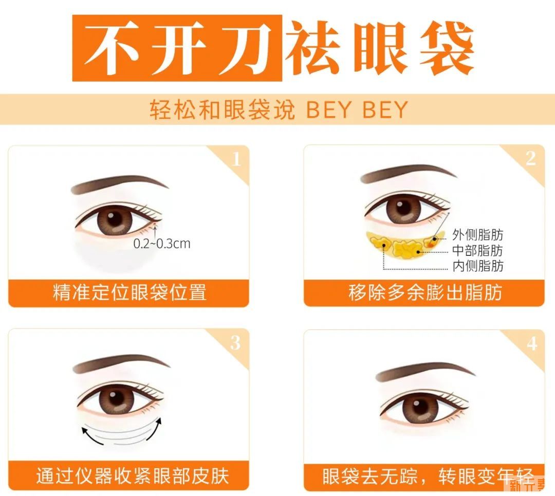 博仕女神季·如何判断自己是否要祛眼袋? 图片-3