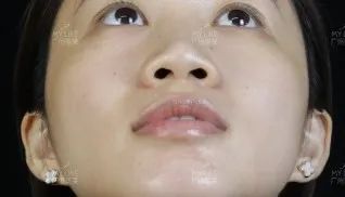 Lisa妹妹鼻子的事藏不住了!! 图片-9