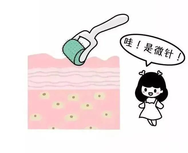 伊肤泉微针，让你皮肤回到少女时代 图片-5