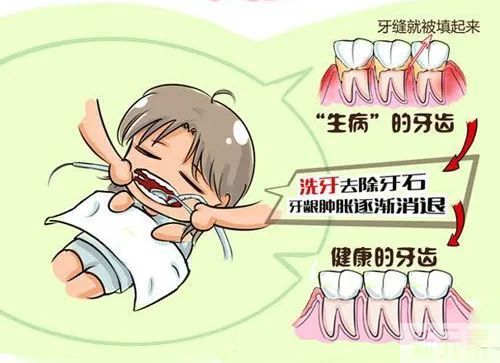 科普 