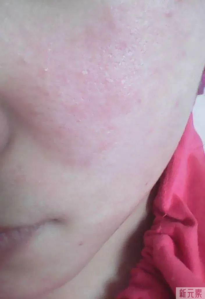 敏感肌福利 