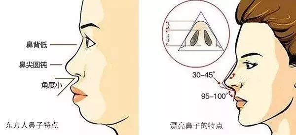 隆鼻后，她们都不会挖鼻孔了! 图片-22