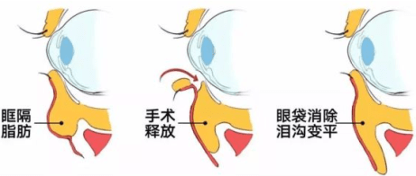 让人显老又变丑的它，居然怕这个? 图片-6