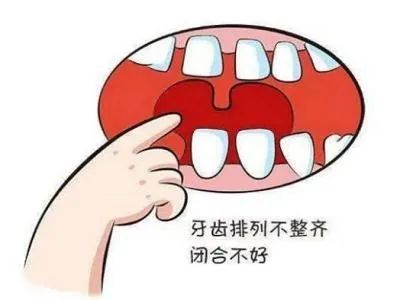 正畸过程中，你可能会遇到的3大问题! 图片-10