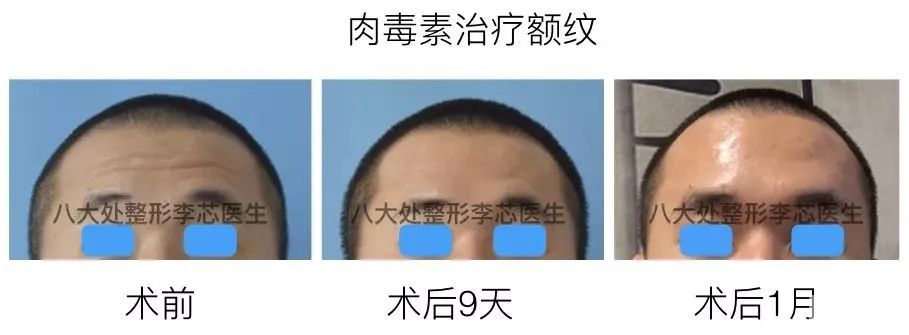 去你的抬头纹! 图片-15