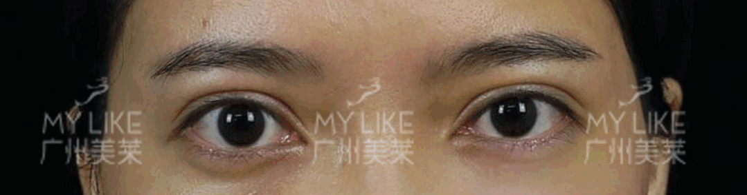 小s近照脸好僵，网友:打了1斤玻尿酸? 图片-5