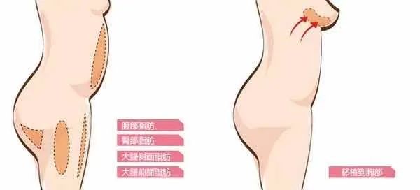 吃猪蹄能丰胸?猪蹄:我没有，别瞎说! 图片-23