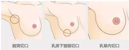 吃猪蹄能丰胸?猪蹄:我没有，别瞎说! 图片-28
