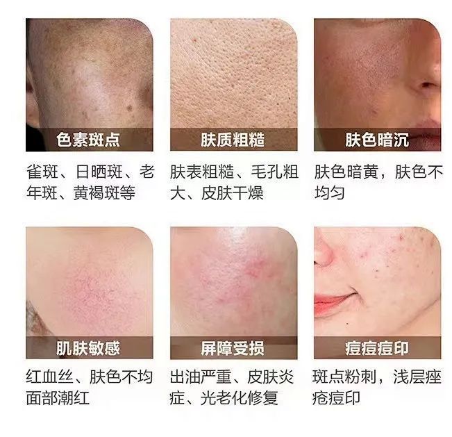高效变美又省钱，这个项目让你赢过美颜相机! 图片-3