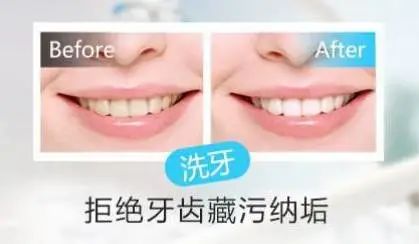 科普 