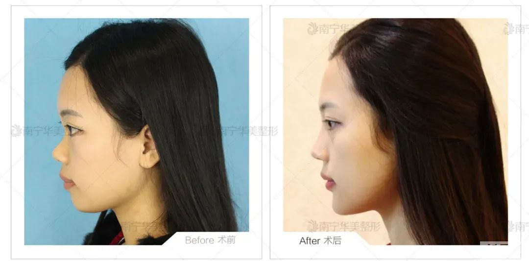 想要快速提升颜值?我推荐你尝试这几个项目 图片-8