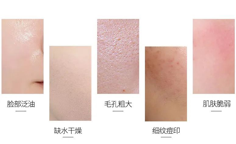满脸的红肿痘，刷酸有用吗? 图片-9
