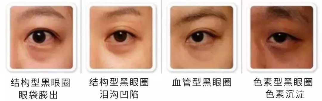 「美丽分享」眼霜到底能不能祛除眼袋? 图片-3