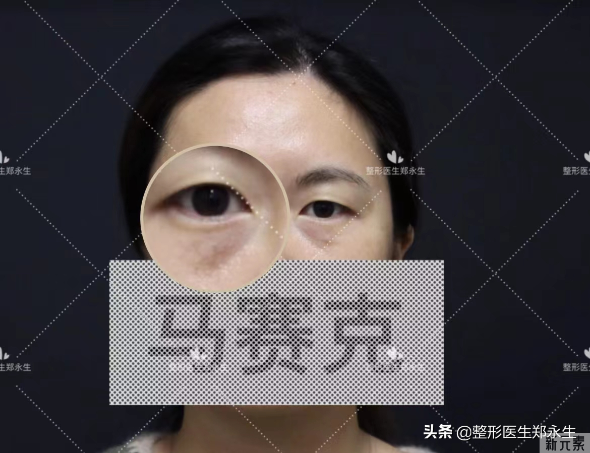 30岁的我贴黄瓜去眼袋翻车后，决定采用这种方法...... 图片-1