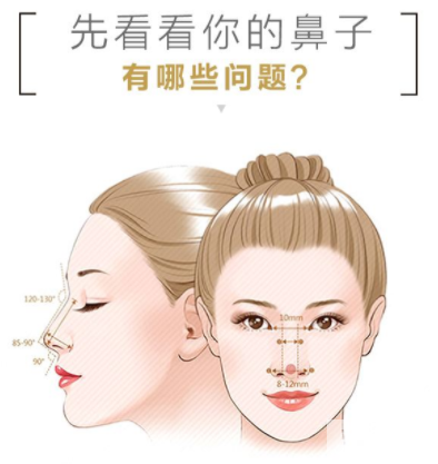 各种隆鼻材料，你该怎么选? 图片-1