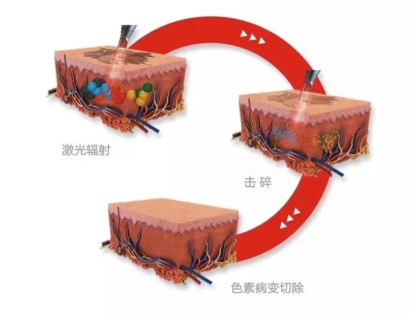 斑点顽固祛不掉?科学祛斑才是正道 图片-9
