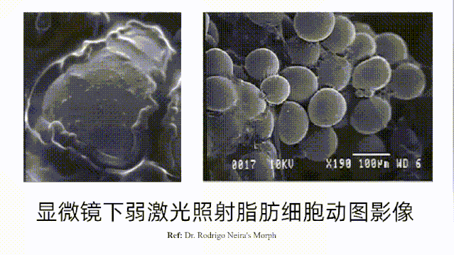 激光照一照就能瘦?!这究竟是噱头还是真的黑科技? 图片-6