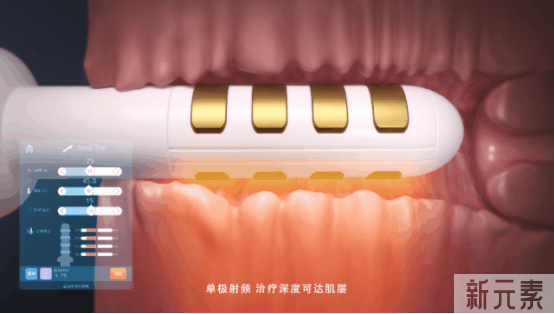 SIMI热玛吉，让你“由内而外”重拾年轻态 图片-8