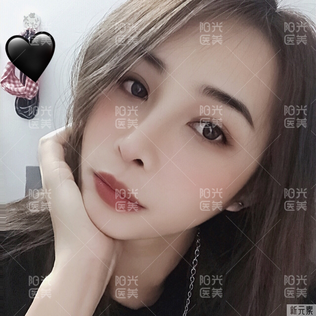 你为什么看起来总是很困? 图片-11