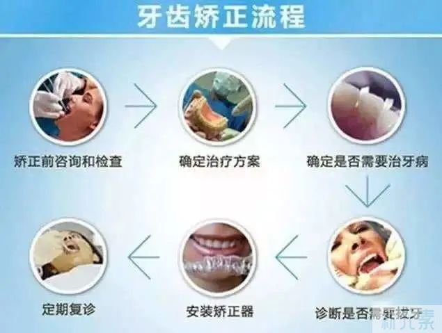 如何拥有一口整齐洁白的牙齿?这5个建议至关重要! 图片-5
