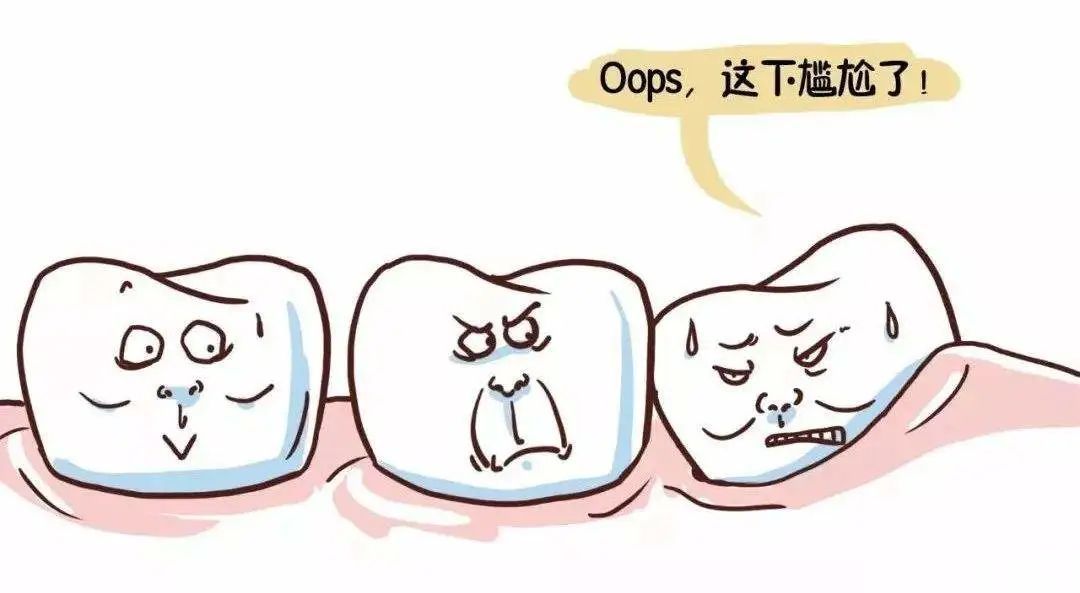 智齿不痛拔不拔?医生:这些被点名的智齿都要拔! 图片-11
