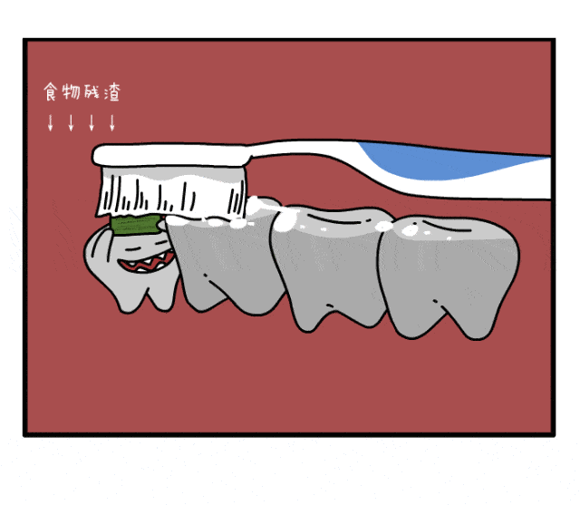 智齿不痛拔不拔?医生:这些被点名的智齿都要拔! 图片-18