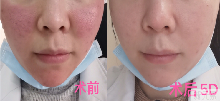 胆子真大!皮肤发红发痒掉屑还在狂抹护肤品?你要抗炎啦! 图片-12