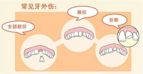 清明节 