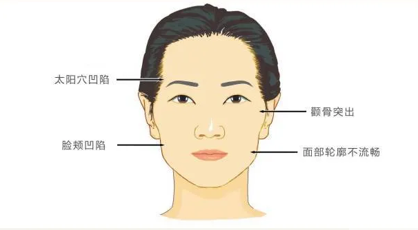你都不知道，没有浅层纹的你能有多美! 图片-4