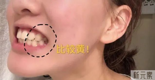 漱口水9.9、洁牙68元、牙美白3次888元秒!限时抢! 图片-19