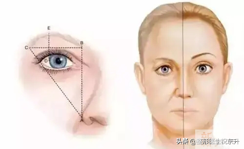 提眉手术和拉皮手术可以一起做吗?    图片-1