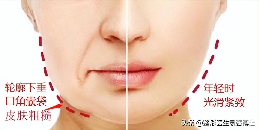 45岁后脸越来越方、发腮?别担心，医生给你支几招，实用有效 图片-1