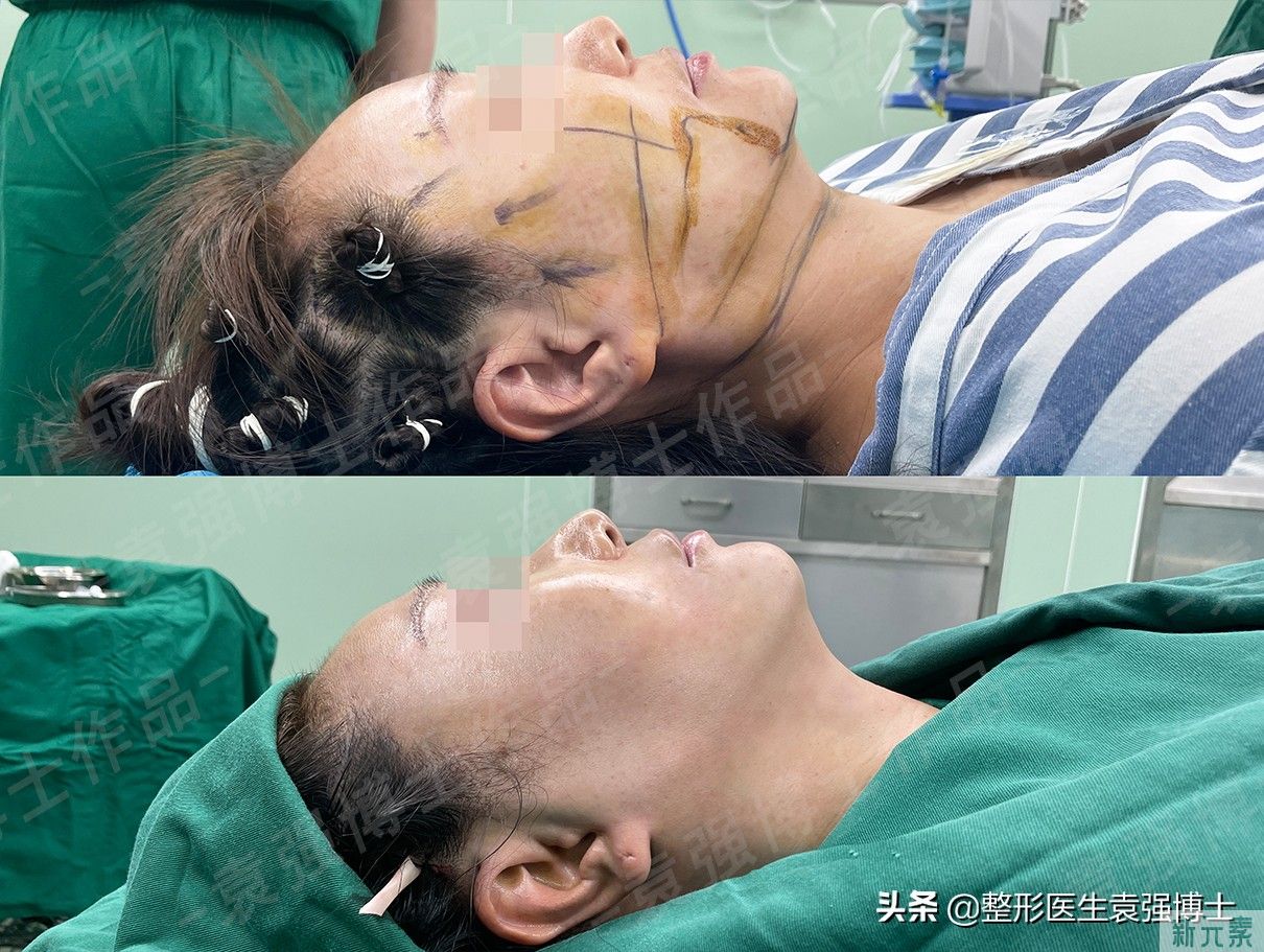 45岁后脸越来越方、发腮?别担心，医生给你支几招，实用有效 图片-4