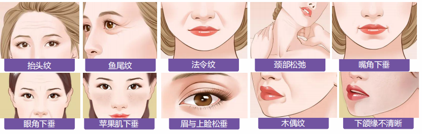 效果维持5-8年!这个立竿见影的抗衰手术，胜在哪里? 图片-10