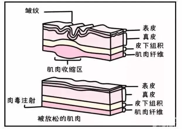 打完脸垮到脖子??瘦脸还真不背这个锅... 图片-5