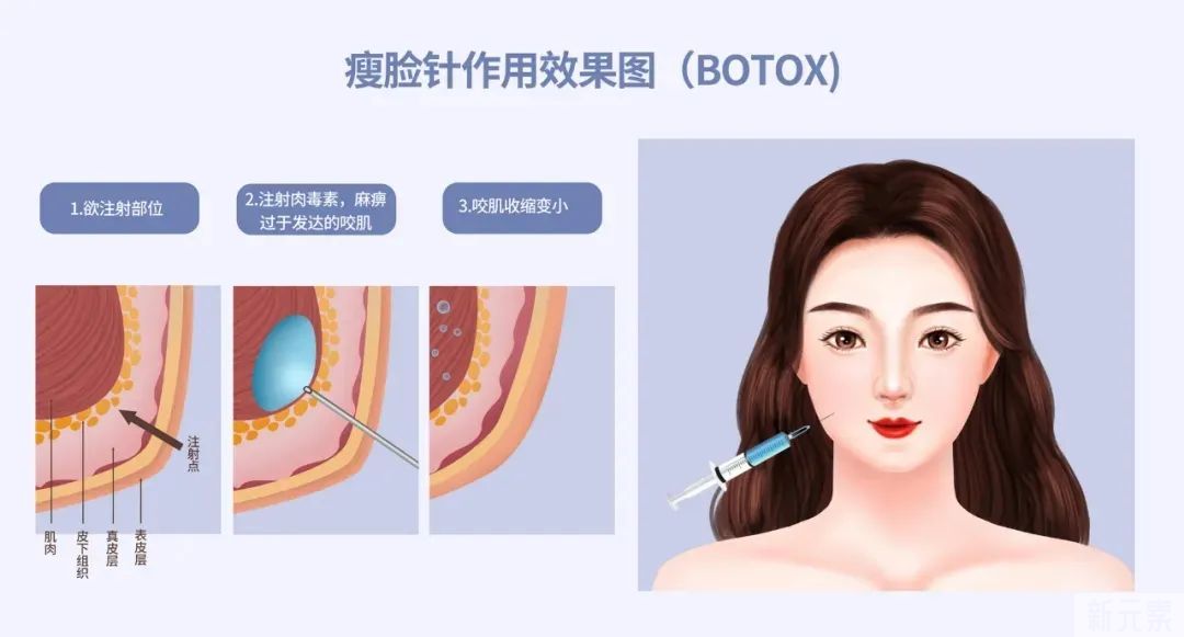 打完脸垮到脖子??瘦脸还真不背这个锅... 图片-8