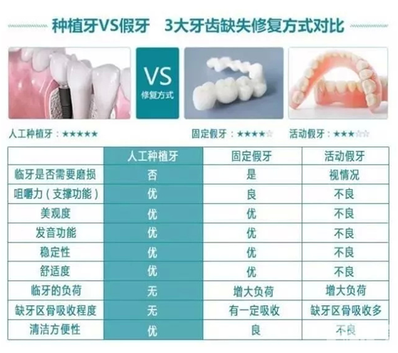 牙缺损了怎么补?做种植牙，还是假牙? 图片-6