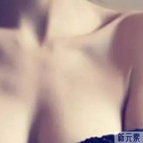 做隆胸，影响乳沟的因素有哪些? 图片-2