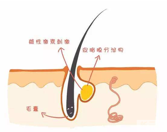 皮肤为何这么油腻?控油方法帮你准备好了 图片-4