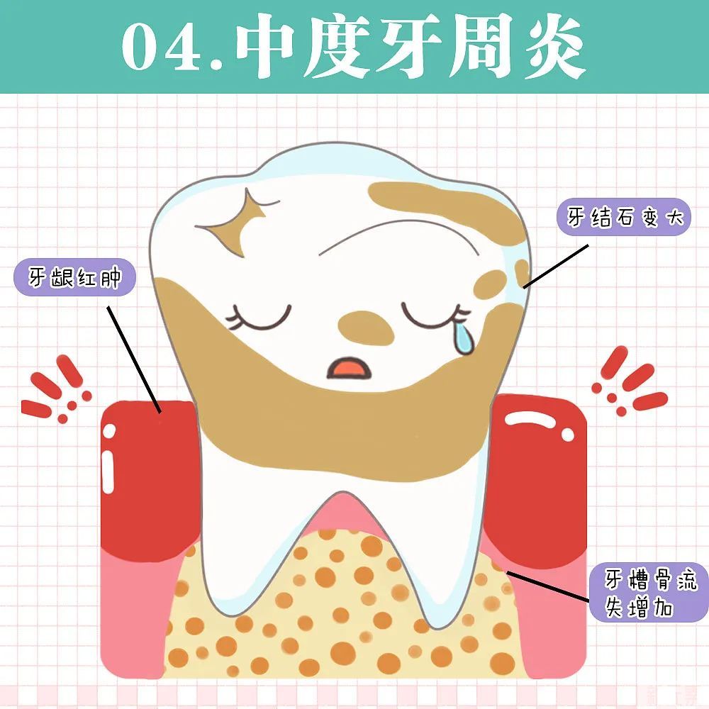 牙疼是因为什么原因引起的？没想到你是这样的牙疼...... 图片-11