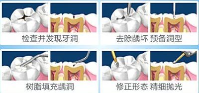 世界卫生日 | 您的口腔卫生达标了吗? 图片-9